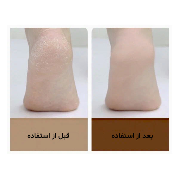 سنگ پا برقی دوکو مدل CR