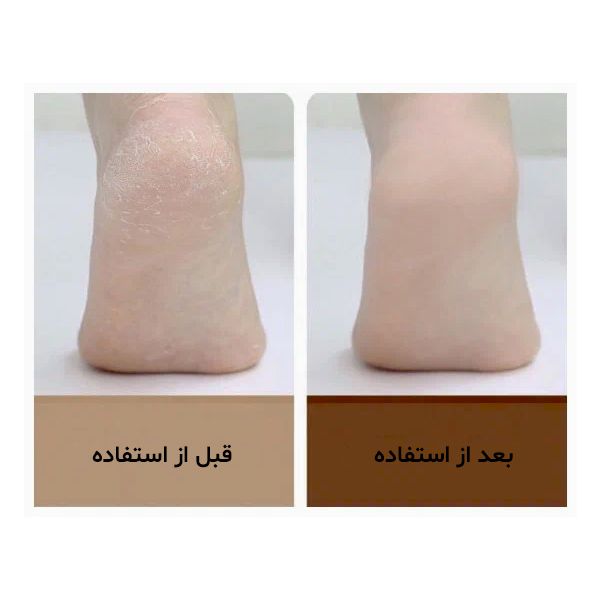 سنگ پا برقی دوکو مدل CR -  - 4
