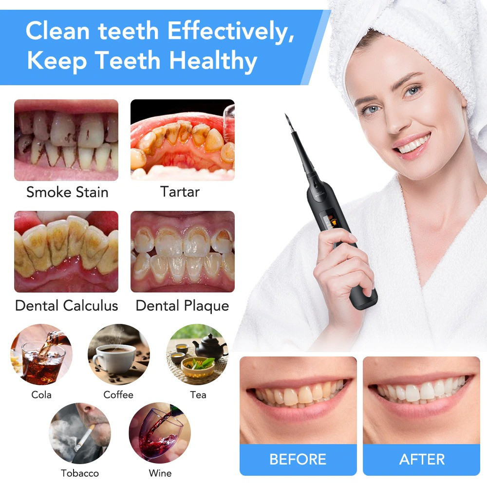 جرم گیر دندان برقی مدل DR-2550