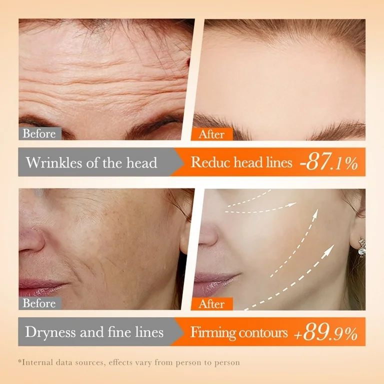 مجموعه مراقبت از پوست سادور مدل کلاژن جذبی و ویتامین ث مجموعه 5 عددی -  - 4