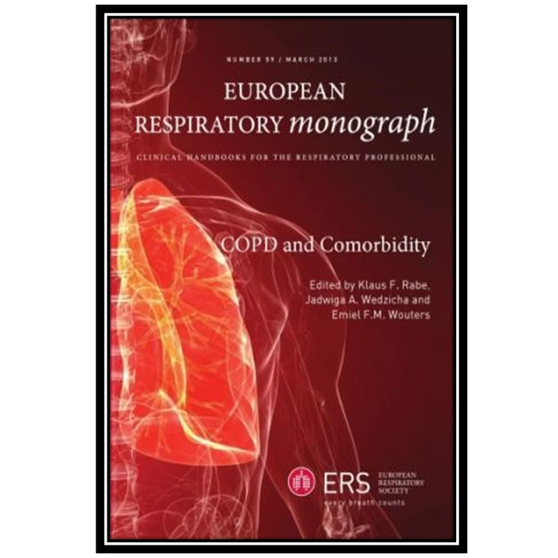 کتاب COPD and Comorbidity اثر جمعی از نویسندگان انتشارات مؤلفین طلایی