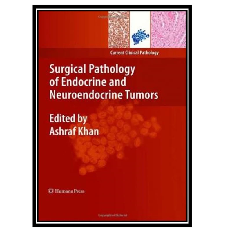 کتاب Surgical Pathology of Endocrine and Neuroendocrine Tumors اثر جمعی از نویسندگان انتشارات مؤلفین طلایی