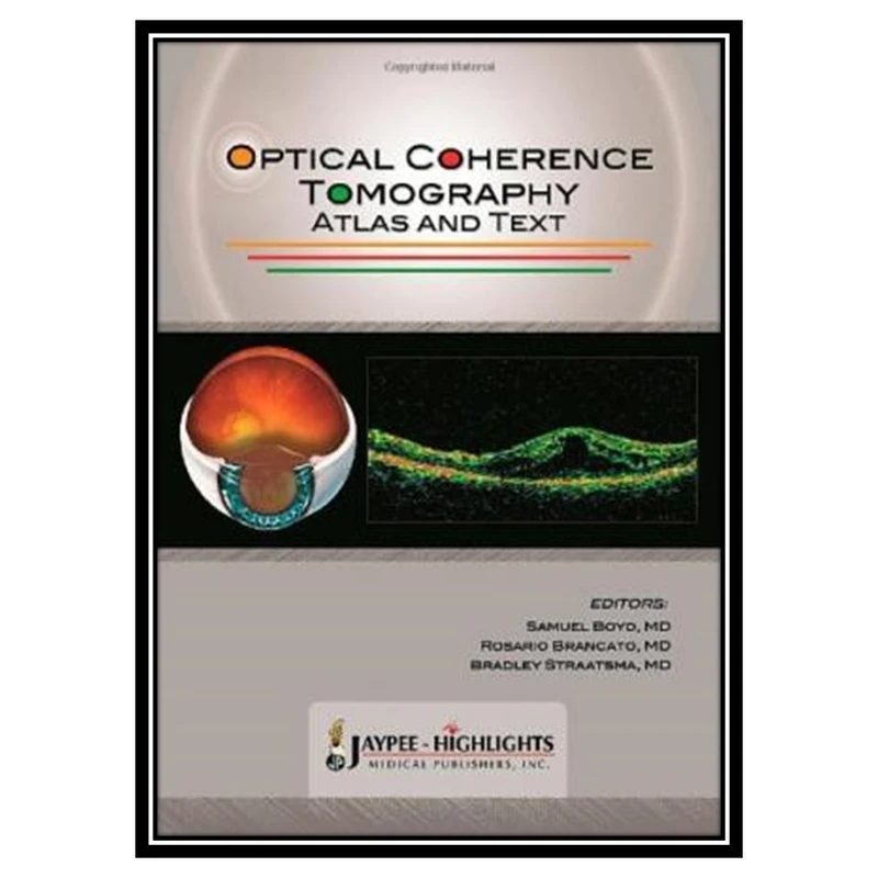  کتاب Optical Coherence Tomography - Atlas and Text اثر جمعی از نویسندگان انتشارات مؤلفین طلایی