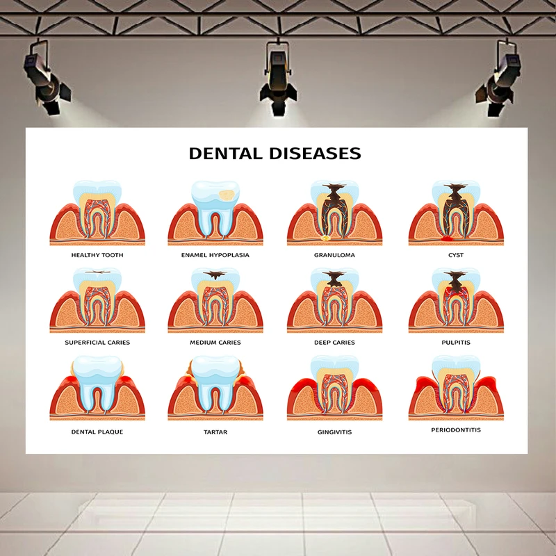 کاغذ دیواری مدل بیماری های دندان کد AR305584