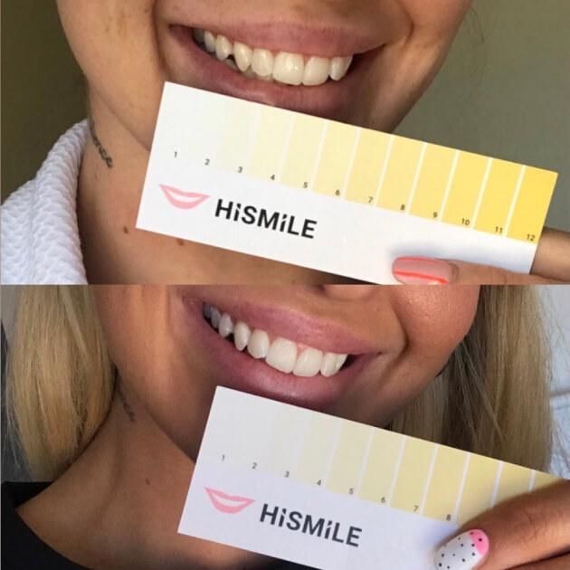 دستگاه سفید کننده دندان های اسمایل مدل 2022 - - 5