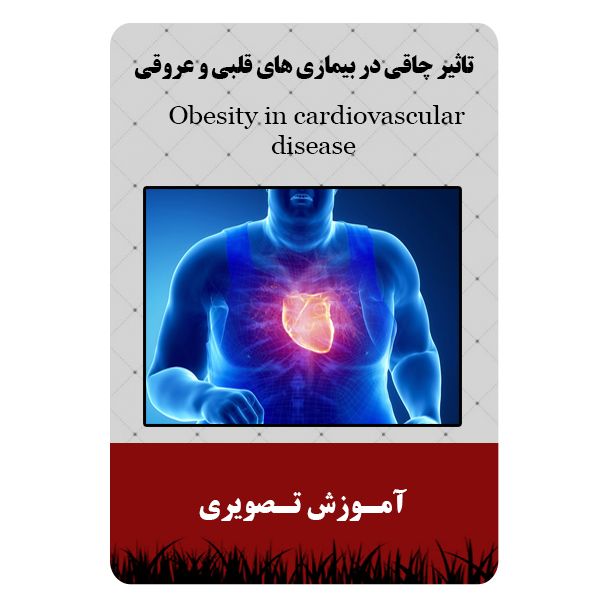 ویدئو آموزشی تاثیر چاقی در بیماری های قلبی و عروقی نشر مبتکران