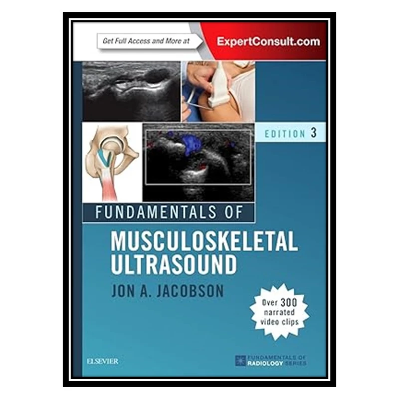 کتاب Fundamentals of Musculoskeletal Ultrasound اثر Jon A. Jacobson انتشارات مؤلفین طلایی