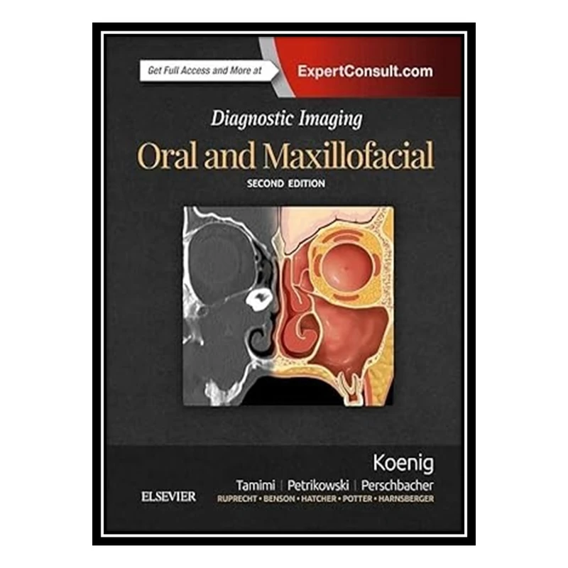 کتاب Diagnostic Imaging: Oral and Maxillofacial اثر جمعی از نویسندگان انتشارات مؤلفین طلایی