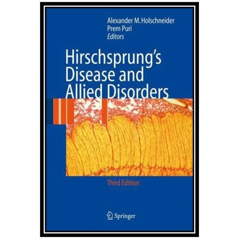 کتاب Hirschsprung's disease and allied disorders with 49 tables اثر Alexander Matthias Holschneider and Prem Puri انتشارات مؤلفین طلایی