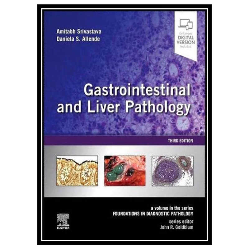 کتاب Gastrointestinal and Liver Pathology اثر جمعی ازنویسندگان انتشارات مؤلفین طلایی