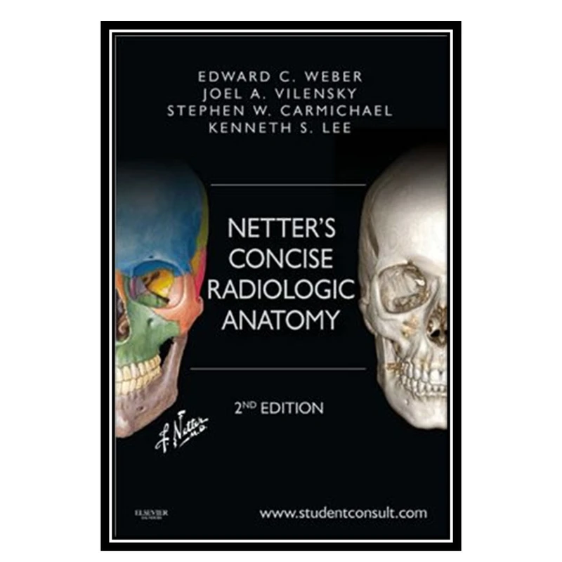 کتاب Netters Concise Radiologic Anatomy اثر جمعی ازنویسندگان انتشارات مؤلفین طلایی