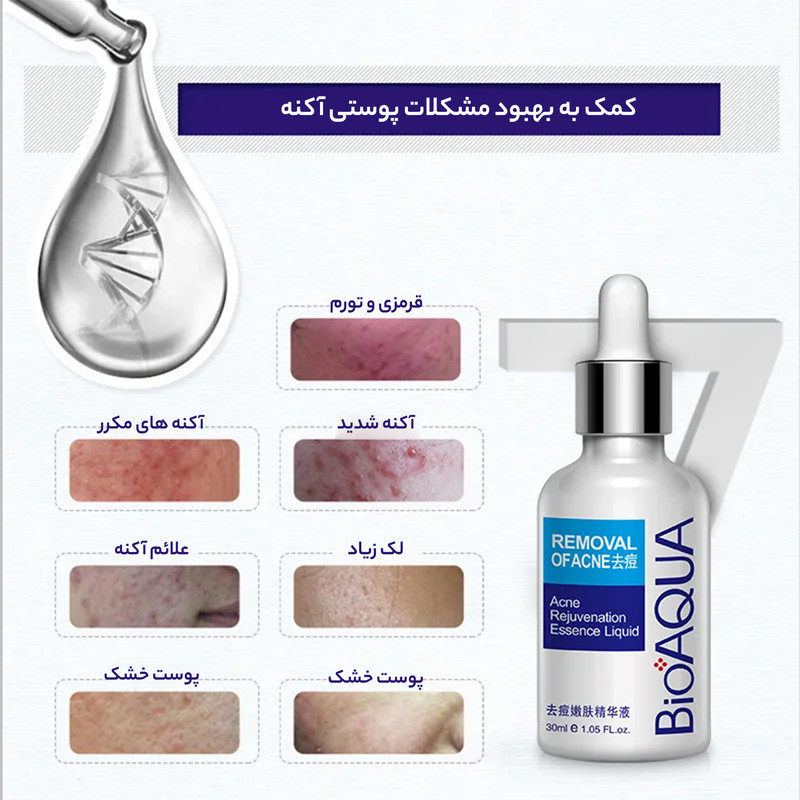 سرم ضد جوش بایو آکوا مدل ترمیم کننده حجم 30 میلی لیتر سرم ضد جوش بایو آکوا مدل ترمیم کننده حجم 30 میلی لیتر