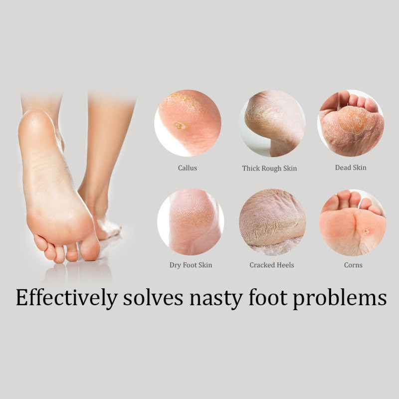 سوهان پا سیل استار مدل SL-PINK