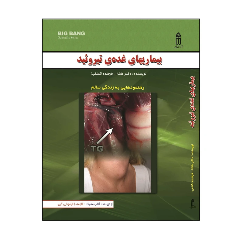 کتاب بیماریهای غدهی تیروئید اثر دکتر ماشالله فرخنده (کشفی) انتشارات قدیس