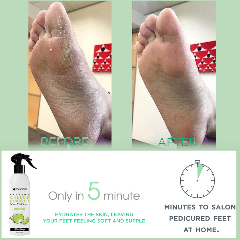 اسپری لایه بردار پا مونیمار مدل کلوس ریموور مناسب برای انواع پوست حجم 250 میلی لیتر