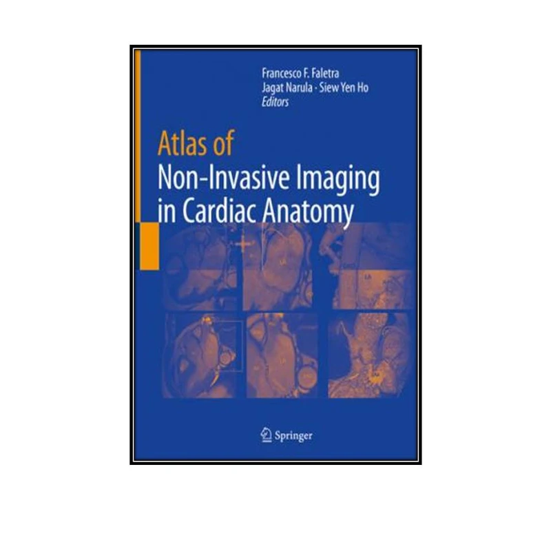 کتاب Atlas of Non-Invasive Imaging in Cardiac Anatomy اثر جمعی از نویسندگان انتشارات مولفین طلایی