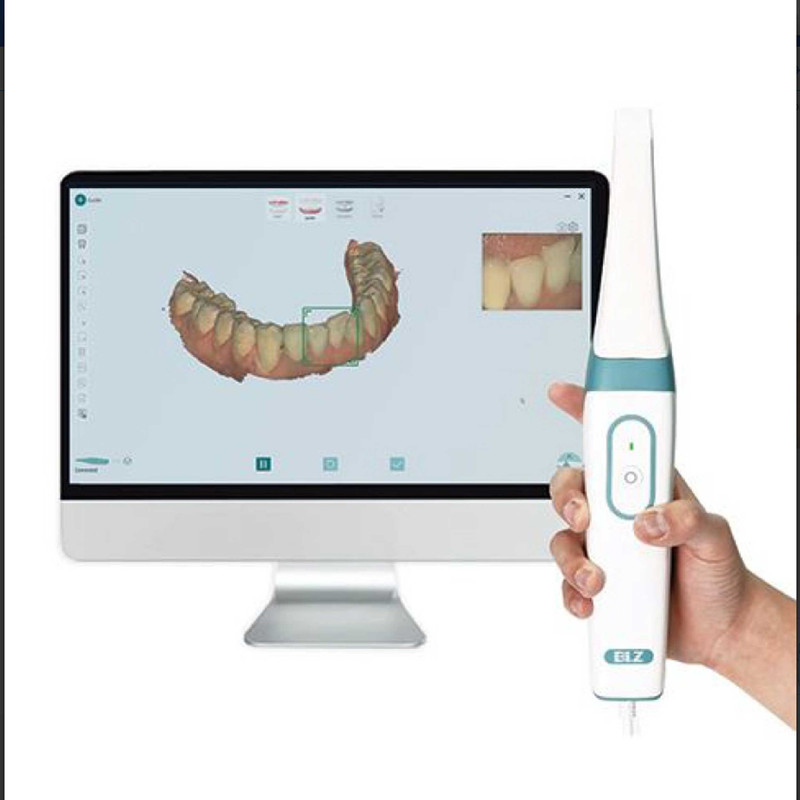 اسکنر داخل دهانی بی ال زد تک مدل Intraoral