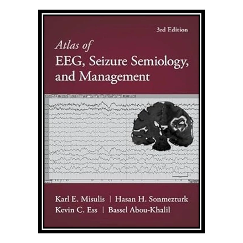 کتاب Atlas of EEG, Seizure Semiology, and Management اثر جمعی از نویسندگان انتشارات مؤلفین طلایی