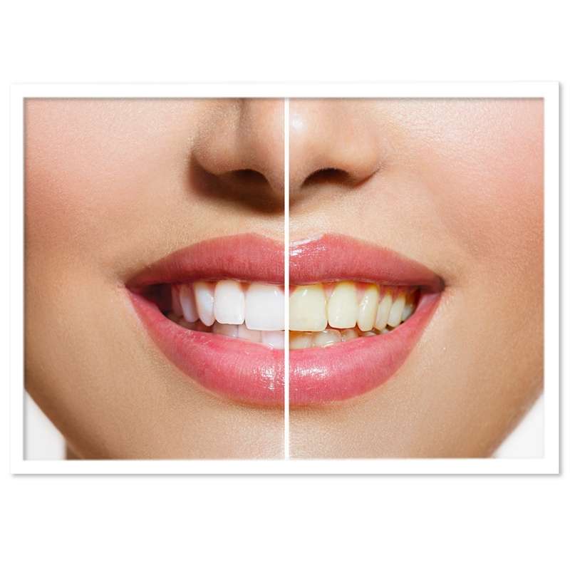 تابلو نوری بکلیت طرح دندان پزشکی و لبخند مدل W-S690