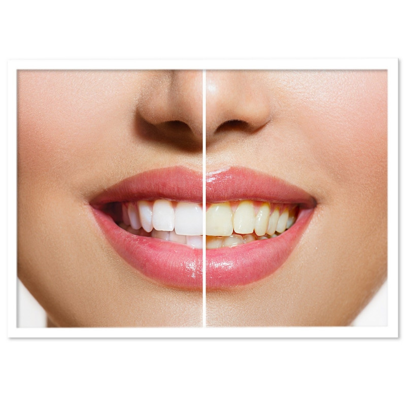 تابلو نوری بکلیت طرح دندان پزشکی و لبخند مدل W-S690