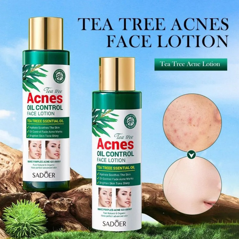 لوسیون ضد جوش سادور مدل چای سبز حجم 120 میلی لیتر