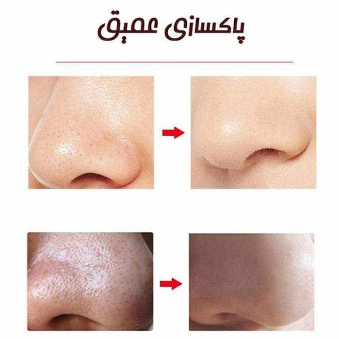 میکرودرم خانگی مدل SCRW-5 میکرودرم خانگی مدل SCRW-5