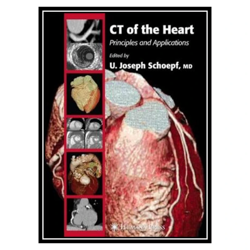 کتاب CT of the Heart Principles and Applications اثر U. Joseph Schoepf انتشارات مؤلفین طلایی 