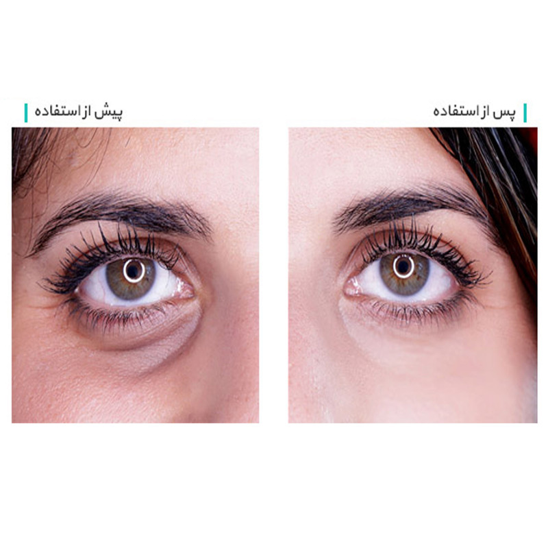 کانسیلر آرت اسکین شماره 01 حجم 8 میلی لیتر