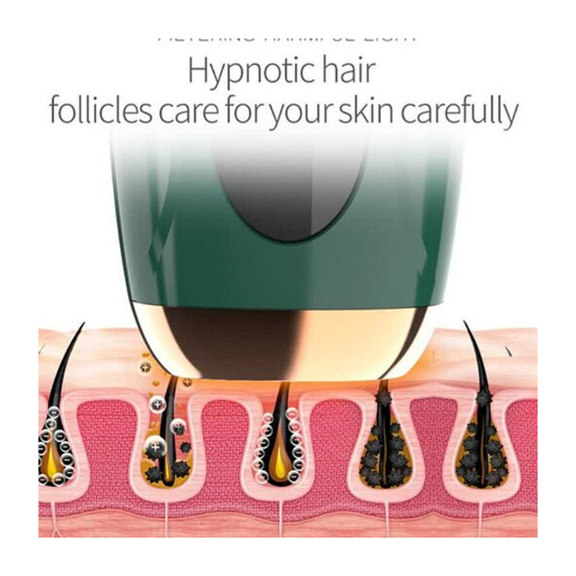 دستگاه لیزر موهای زائد مدل IPL