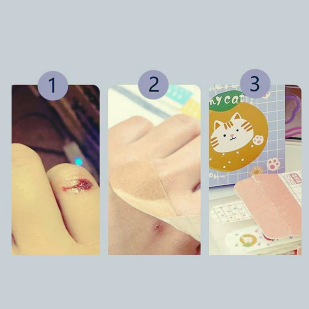 چسب زخم مدل سومیکو کد FBS بسته 5 عددی