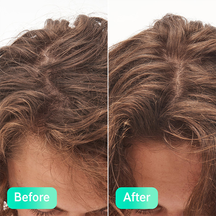 سرم مو دی اینکی لیست مدل Glycolic Acid حجم 150 میلی لیتر