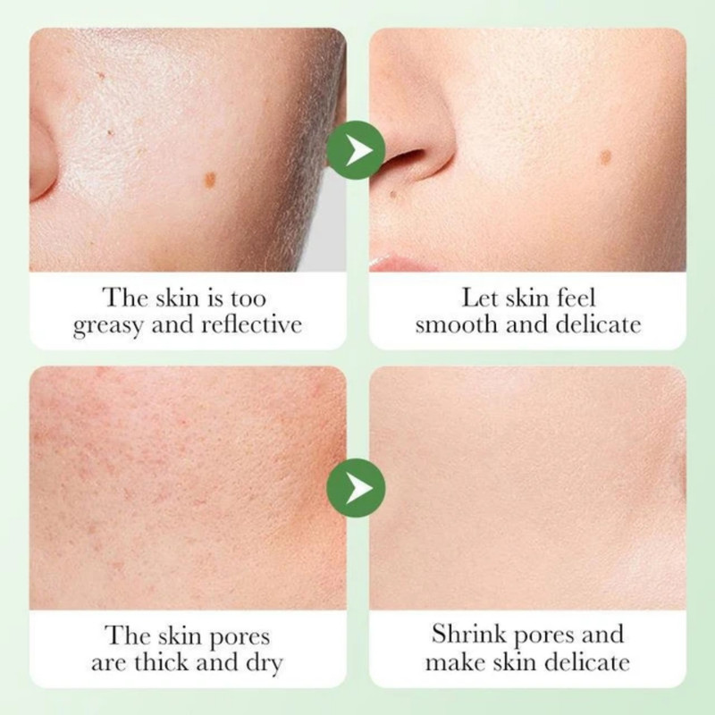 مجموعه مراقبت از پوست بایو آکوا مدل کوچک کننده منافذ سنتلا بسته 6 عددی