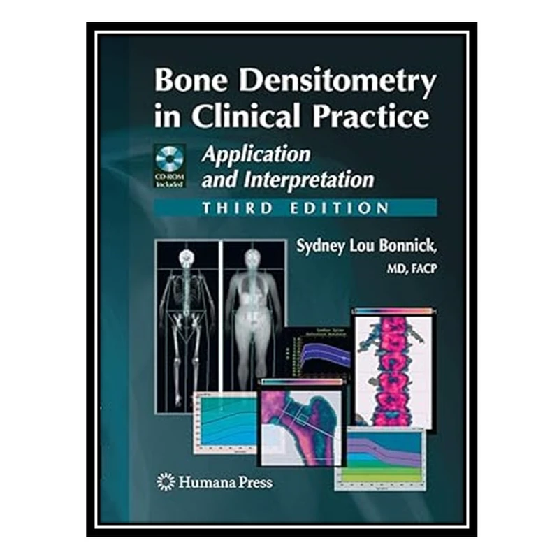 کتاب Bone Densitometry in Clinical Practice: Application and Interpretation اثر Sydney Lou Bonnick انتشارات مؤلفین طلایی