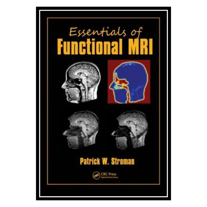کتاب Essentials of Functional MRI اثر Patrick W. Stroman انتشارات مؤلفین طلایی