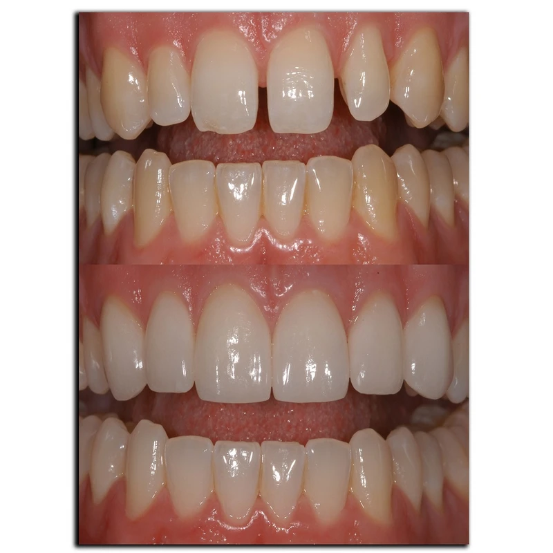 تابلو شاسی بکلیت طرح لمینیت دندان مدل SH-2077