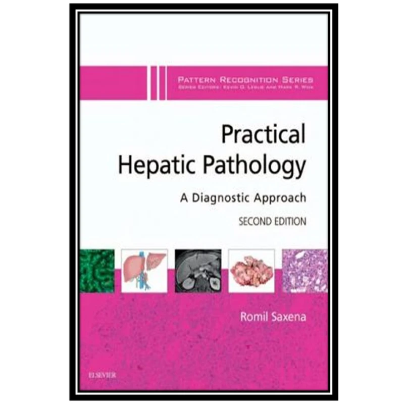 کتاب Practical Hepatic Pathology: A Diagnostic Approach اثر Romil Saxena انتشارات مؤلفین طلایی