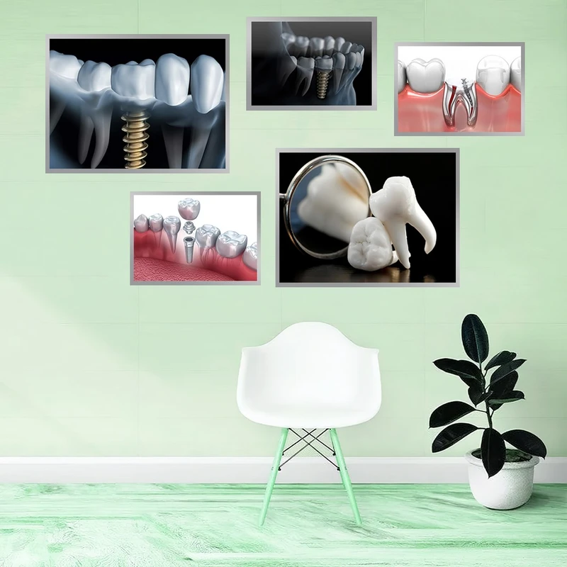تابلو بکلیت طرح ایمپلنت و دندان پزشکی مدل N-931 مجموعه 5 عددی