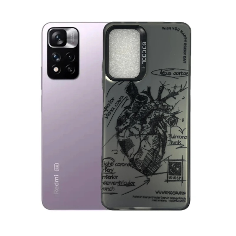 کاور‌ طرح تشریح قلب مناسب برای گوشی موبایل شیائومی Redmi Note 11 Pro 4g