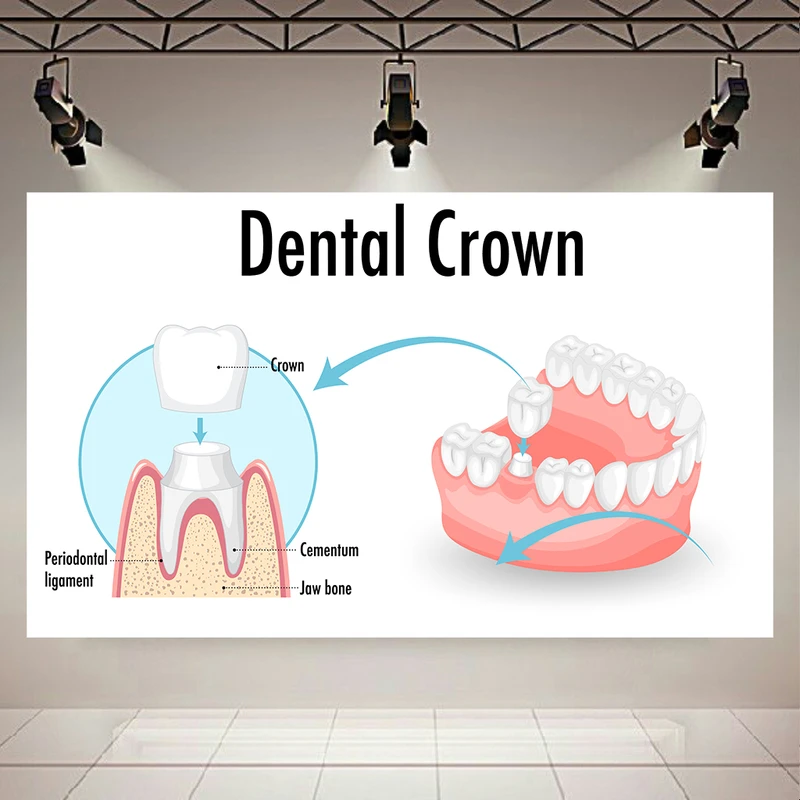 پوستر دیواری طرح دندانپزشکی مدل بازسازی دندان کد AR304348