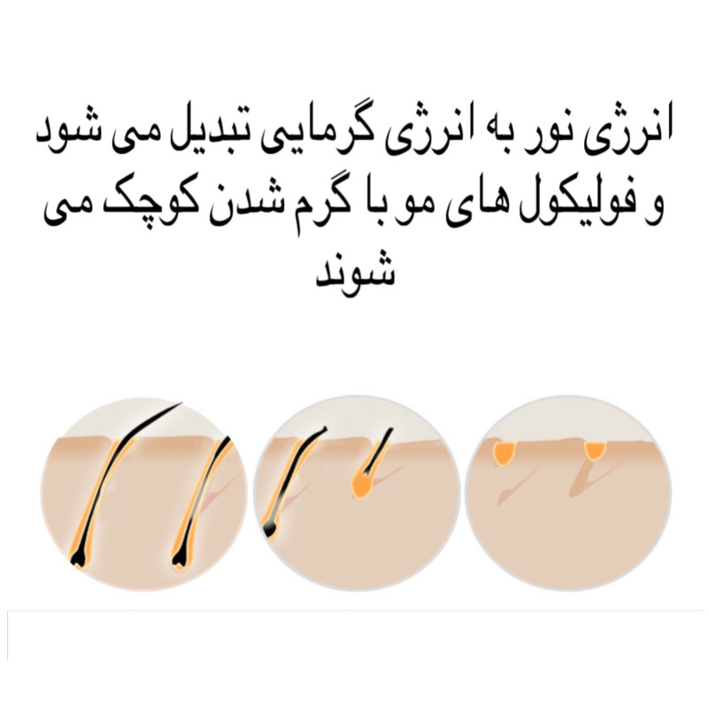 لیزر موهای زائد مدل PHOTON