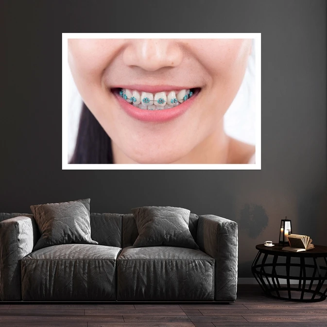 تابلو بکلیت طرح دندانپزشکی و ارتودنسی مدل قاب شاسی W-s10154