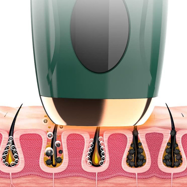 لیزر موهای زائد صورت و بدن ویرن مدل IPL
