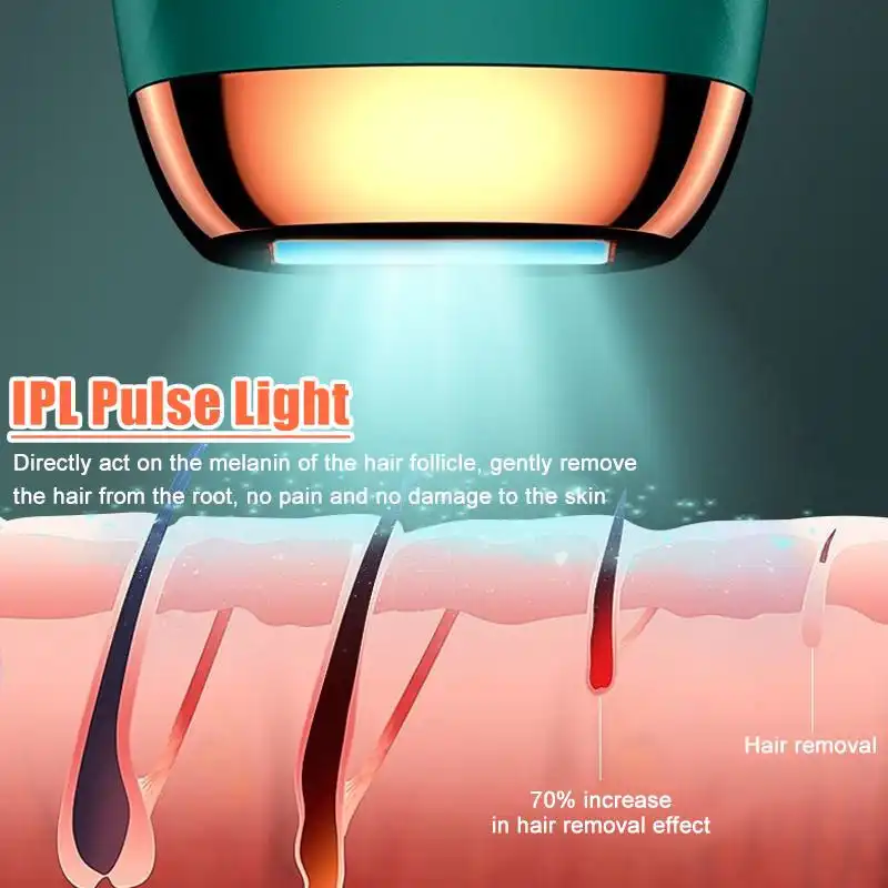 لیزر موهای زائد لونار مدل آی پی ال