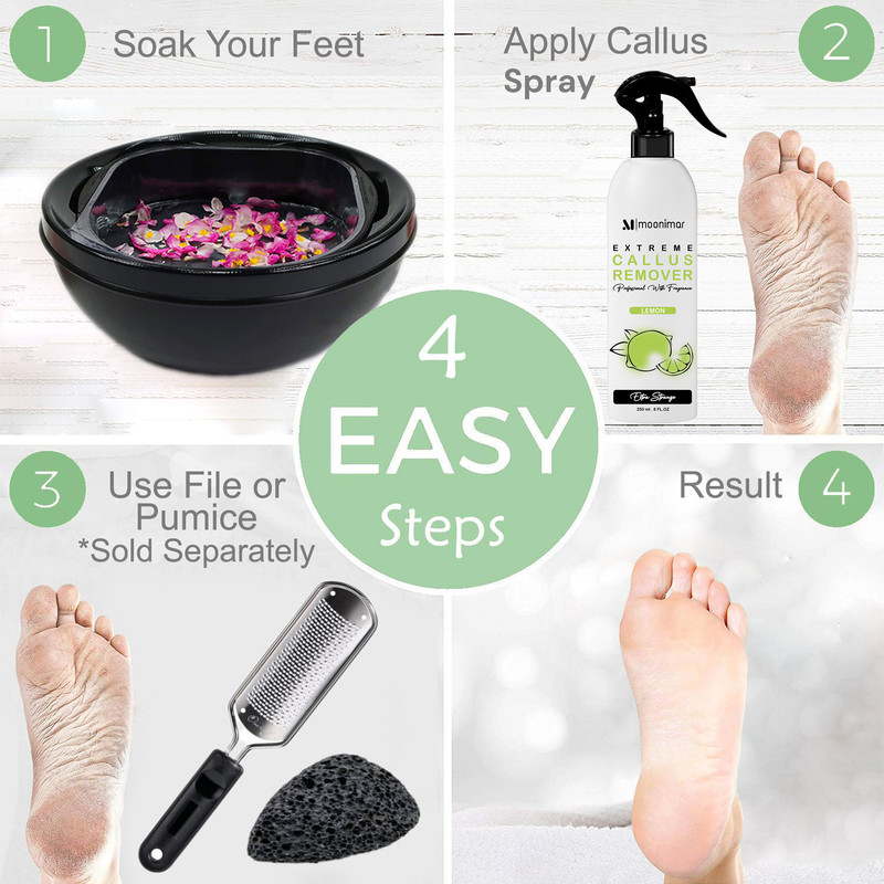 اسپری لایه بردار پا مونیمار مدل کلوس ریموور مناسب برای انواع پوست حجم 250 میلی لیتر