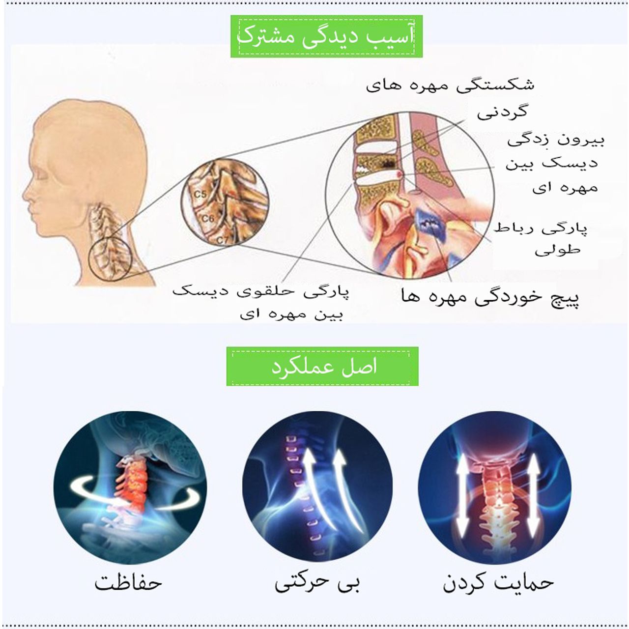 گردن بند طبی مدل LS 2148 S -  - 2