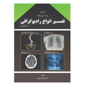 کتاب آموزش پایه تا پیشرفته تفسیر انواع رادیوگرافی اثر جواد قربانی انتشارات ارشدان