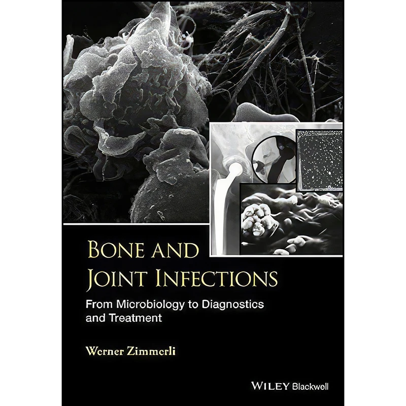 کتاب Bone and Joint Infections اثر W. Zimmerli انتشارات Wiley-Blackwell