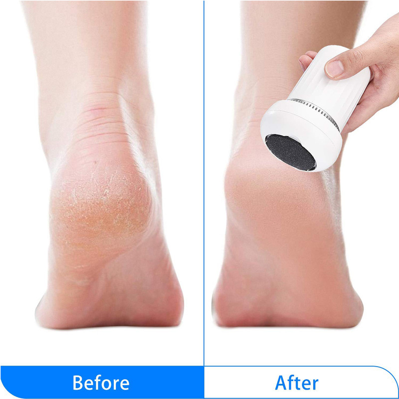 سنگ پا برقی مدل COSYONALL