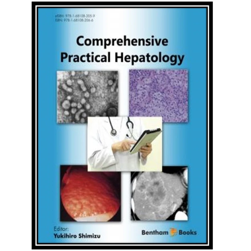 کتاب Comprehensive Practical Hepatology اثر Yukihiro Shimizu انتشارات مؤلفین طلایی