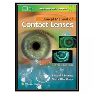 کتاب Clinical Manual of Contact Lenses اثر Vinita Allee Henry OD and Edward S. Bennett OD انتشارات مؤلفین طلایی